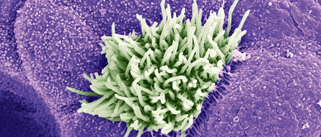 Image courtesy of Bio Tech.