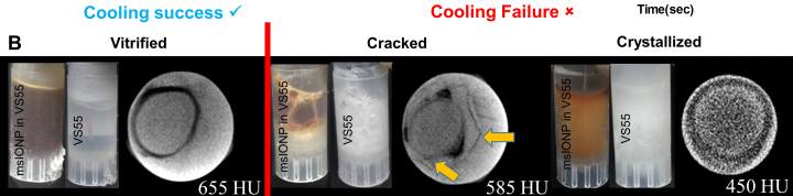 Conventional convective warming puts cryogenically preserved tissues in danger of becoming cracked or crystallized. Image: Manuchehrabadi et al., Science Translational Medicine (2017)